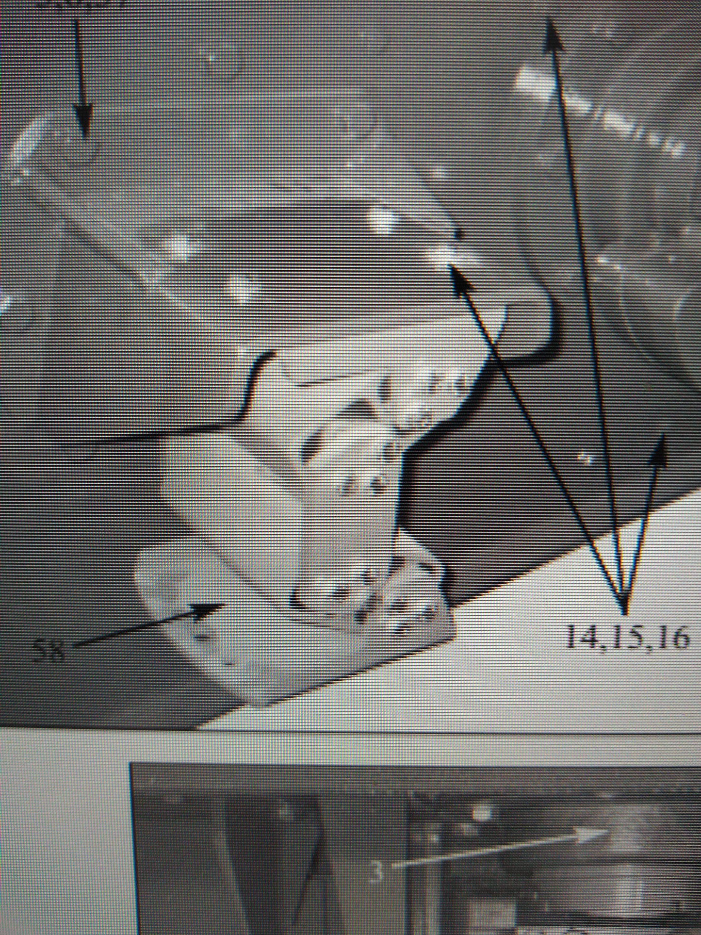 50004 Suspension System